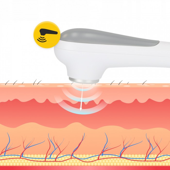 Аппарат для ультразвуковой терапии 4FIZJO Pro+ переносной (P-5905973400008)