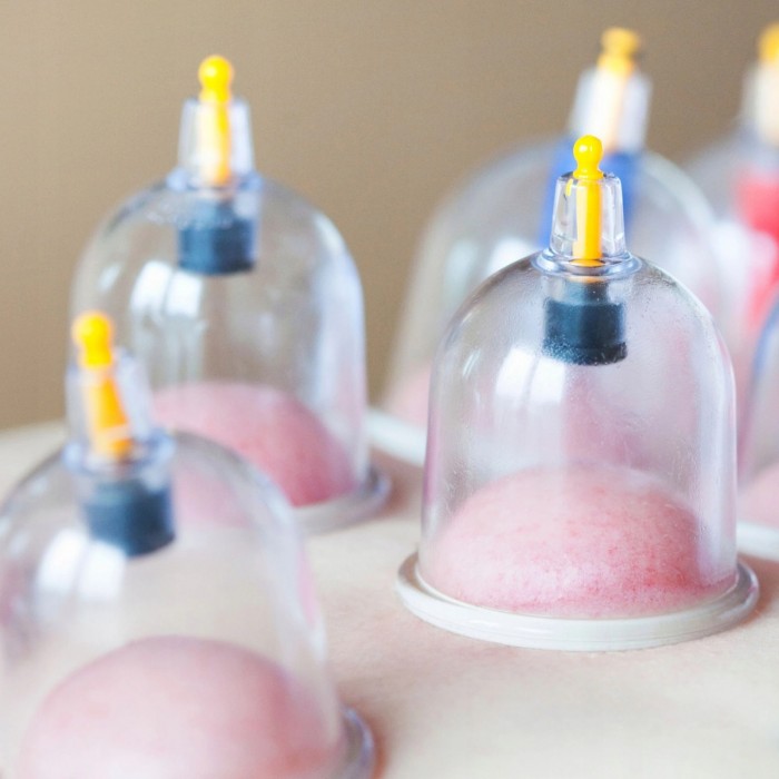 Вакуумні масажні банки 4FIZJO для тіла (китайські/антицелюлітні банки) 12 шт з помпою (P-5907739319906)