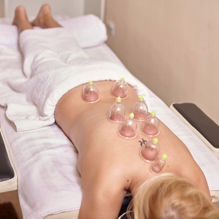 Вакуумні масажні банки 4FIZJO для тіла (китайські/антіцелюлітні банки) 24 шт з помпою (P-5907739319913)